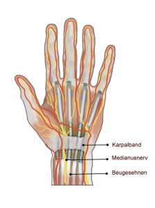 karpaltunnel